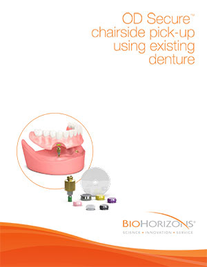 OD Secure chairside pick-up using existing denture module