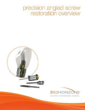 Precision angled screw restoration overview