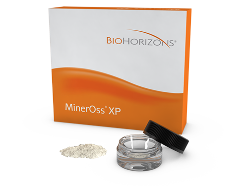 MinerOss-XP-particulate
